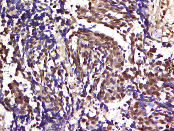 Phospho-CBL2 (Tyr700) Antibody in Immunohistochemistry (Paraffin) (IHC (P))