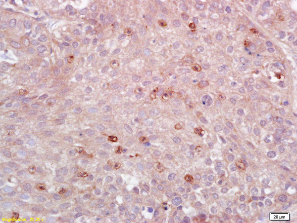 HLA-DPB1 Antibody in Immunohistochemistry (Paraffin) (IHC (P))