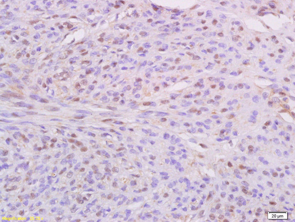 IKBKE Antibody in Immunohistochemistry (Paraffin) (IHC (P))