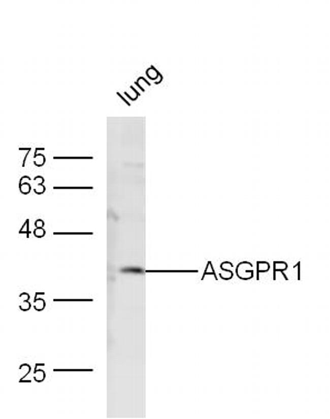 ASGPR1 Antibody in Western Blot (WB)