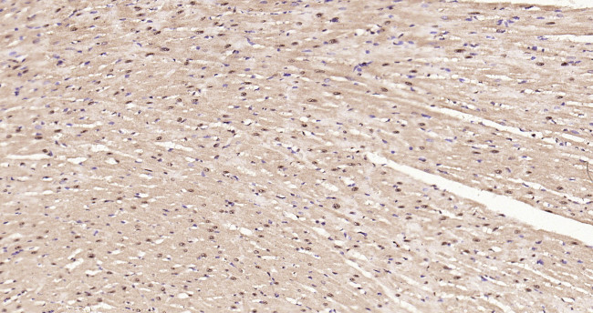TNMD Antibody in Immunohistochemistry (Paraffin) (IHC (P))
