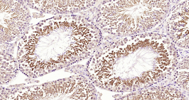 MEK5 Antibody in Immunohistochemistry (Paraffin) (IHC (P))
