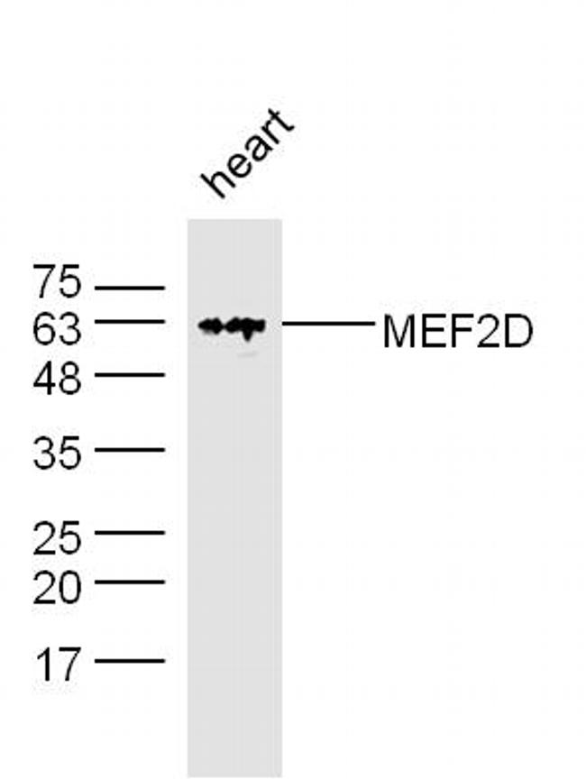 MEF2D Antibody in Western Blot (WB)
