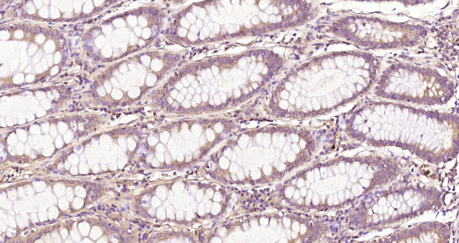 MAPKAPK5 Antibody in Immunohistochemistry (Paraffin) (IHC (P))