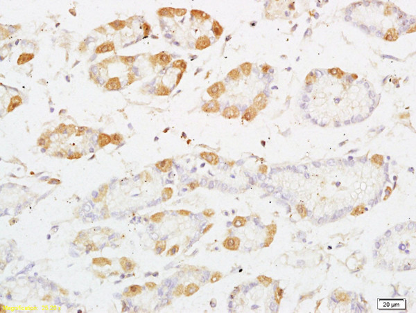 PRKD3 Antibody in Immunohistochemistry (Paraffin) (IHC (P))