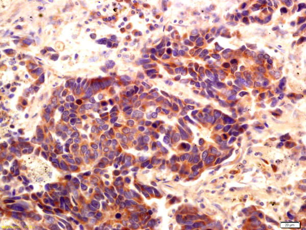 PI 3 Kinase Class 3 Antibody in Immunohistochemistry (Paraffin) (IHC (P))