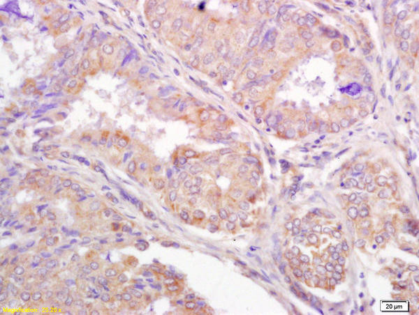 TRIM25 Antibody in Immunohistochemistry (Paraffin) (IHC (P))