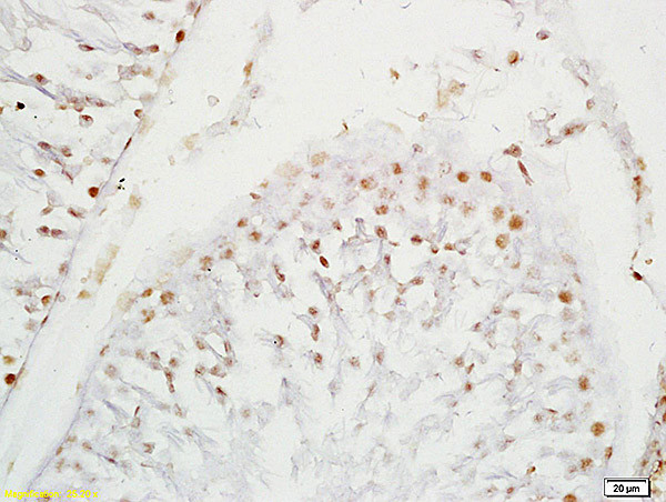 SOX9 Antibody in Immunohistochemistry (Paraffin) (IHC (P))