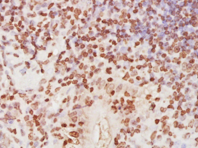 RPA32 Antibody in Immunohistochemistry (Paraffin) (IHC (P))