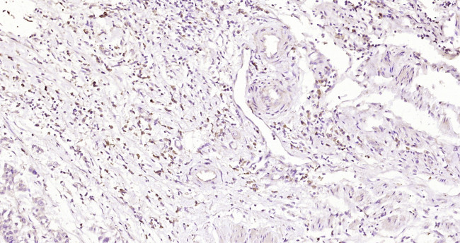 RelB Antibody in Immunohistochemistry (Paraffin) (IHC (P))