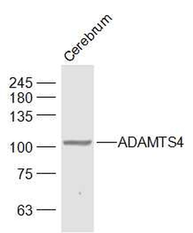 ADAMTS4 Antibody in Western Blot (WB)