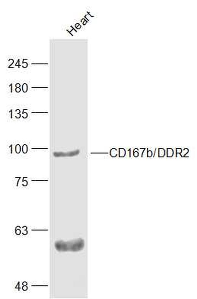 CD167b Antibody in Western Blot (WB)
