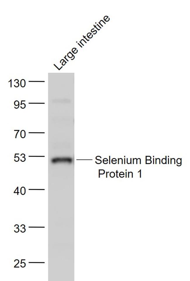 Selenium Binding Protein 1 Antibody in Western Blot (WB)