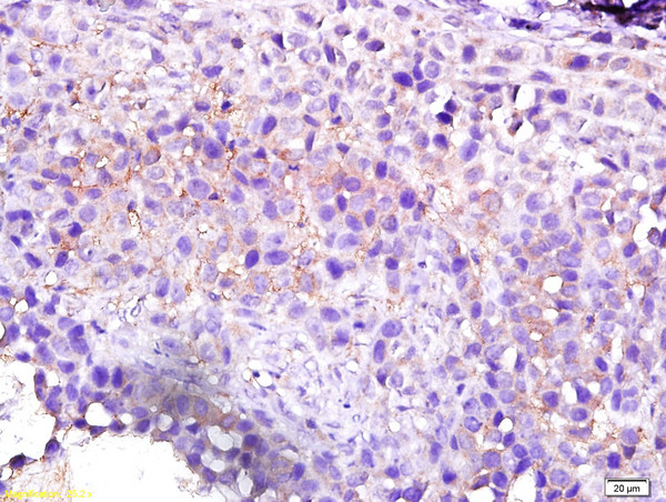 GEF H1 Antibody in Immunohistochemistry (Paraffin) (IHC (P))