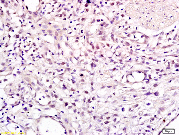CHMP1A Antibody in Immunohistochemistry (Paraffin) (IHC (P))