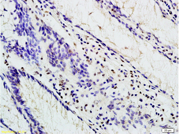 TBL1 Antibody in Immunohistochemistry (Paraffin) (IHC (P))