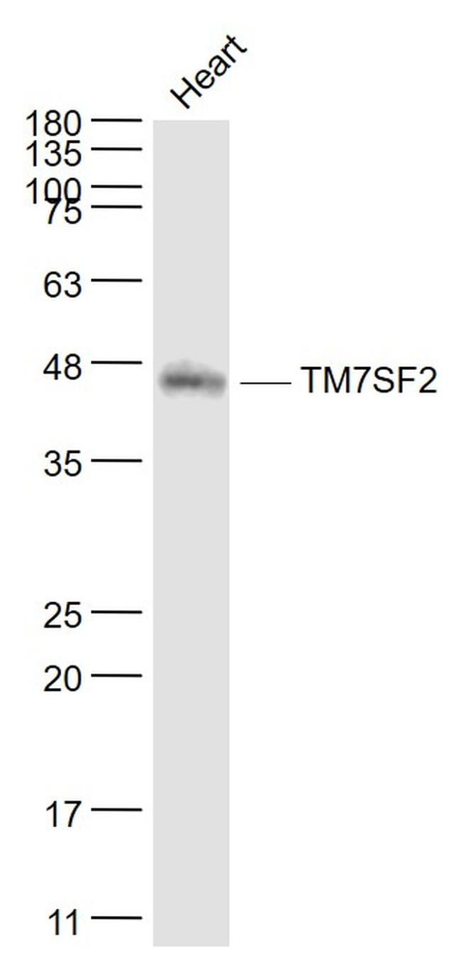 TM7SF2 Antibody in Western Blot (WB)