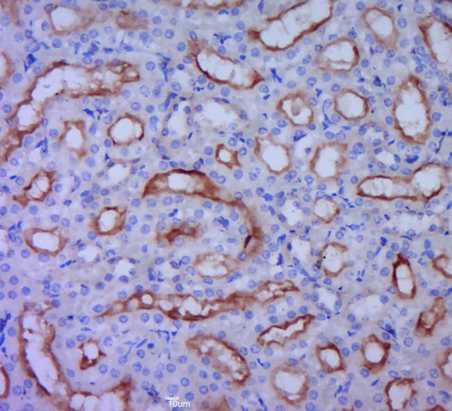 UGT1A9 Antibody in Immunohistochemistry (Paraffin) (IHC (P))