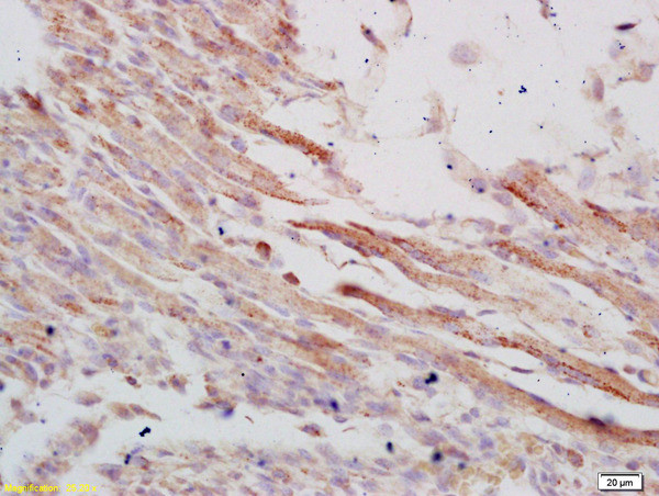 VLDL Receptor Antibody in Immunohistochemistry (Paraffin) (IHC (P))