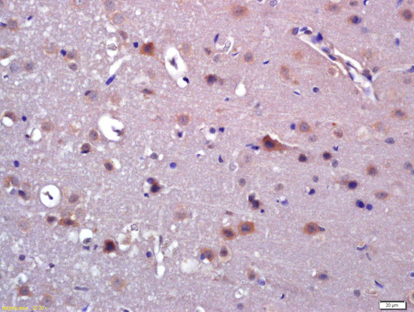 ABAT Antibody in Immunohistochemistry (Paraffin) (IHC (P))