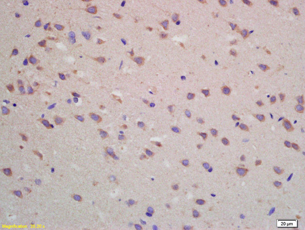 ADORA1 Antibody in Immunohistochemistry (Paraffin) (IHC (P))