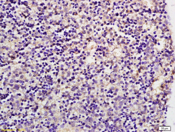 GLUT8 Antibody in Immunohistochemistry (Paraffin) (IHC (P))