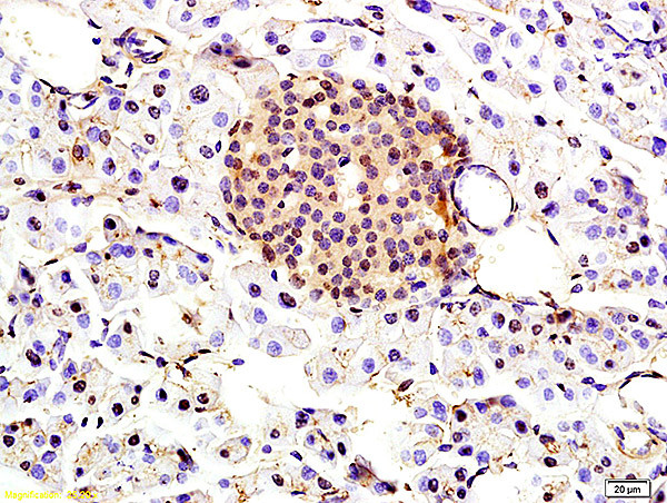 TBRG1 Antibody in Immunohistochemistry (Paraffin) (IHC (P))