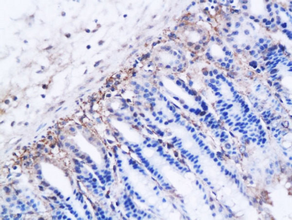 DBC2 Antibody in Immunohistochemistry (Paraffin) (IHC (P))