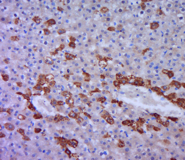 FAT Antibody in Immunohistochemistry (Paraffin) (IHC (P))