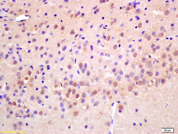 RAD21 Antibody in Immunohistochemistry (Paraffin) (IHC (P))
