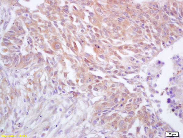 CDC37 Antibody in Immunohistochemistry (Paraffin) (IHC (P))