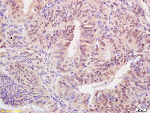 BARD1 Antibody in Immunohistochemistry (Paraffin) (IHC (P))