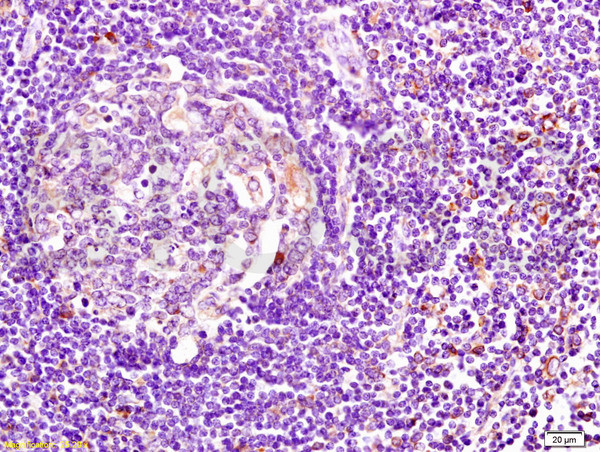CD74 Antibody in Immunohistochemistry (Paraffin) (IHC (P))