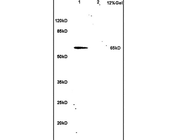 hnRNP L Antibody in Immunohistochemistry (Paraffin) (IHC (P))