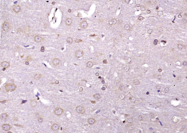 Phospho-IRE1a (Ser726) Antibody in Immunohistochemistry (Paraffin) (IHC (P))