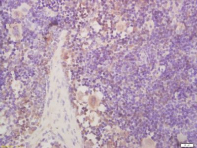 NR0B2 Antibody in Immunohistochemistry (Paraffin) (IHC (P))
