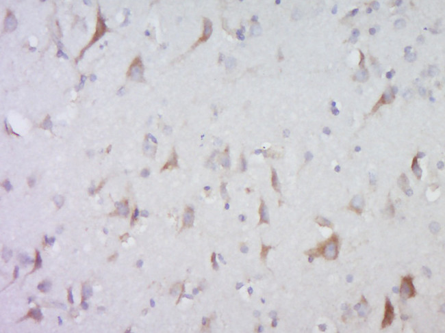 testis antigen 1 Antibody in Immunohistochemistry (Paraffin) (IHC (P))