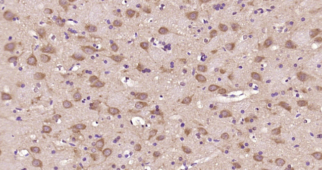 tubulin Beta Antibody in Immunohistochemistry (Paraffin) (IHC (P))