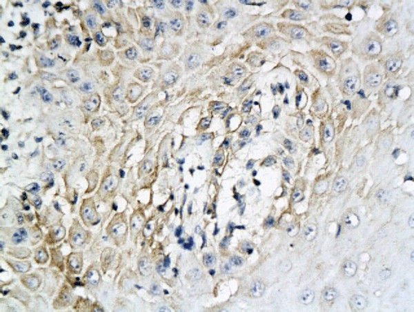 IL-6 Antibody in Immunohistochemistry (Paraffin) (IHC (P))