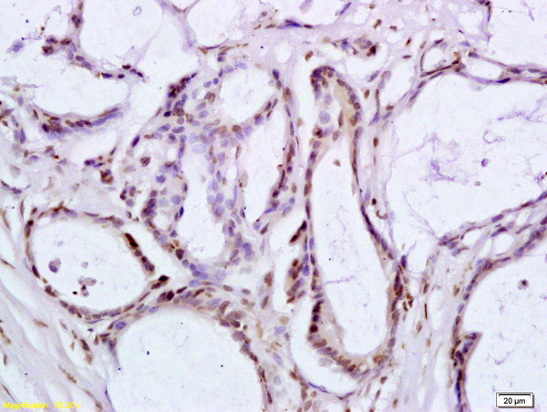 BRLF1 Antibody in Immunohistochemistry (Paraffin) (IHC (P))