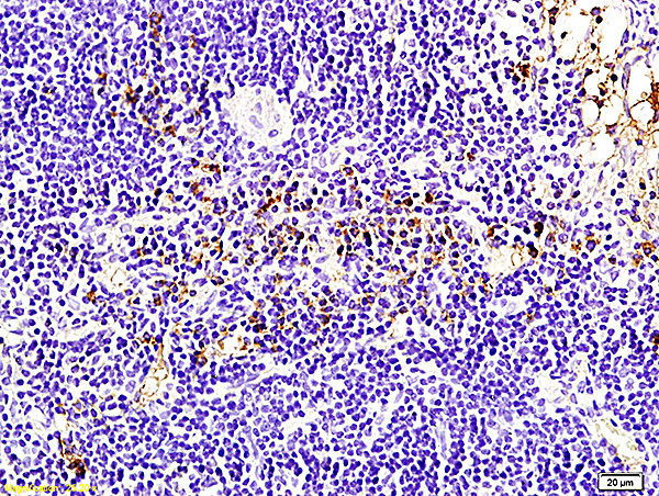 Bcl-2 Antibody in Immunohistochemistry (Paraffin) (IHC (P))