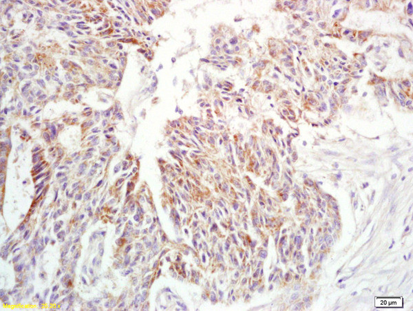 IL-6 Antibody in Immunohistochemistry (Paraffin) (IHC (P))