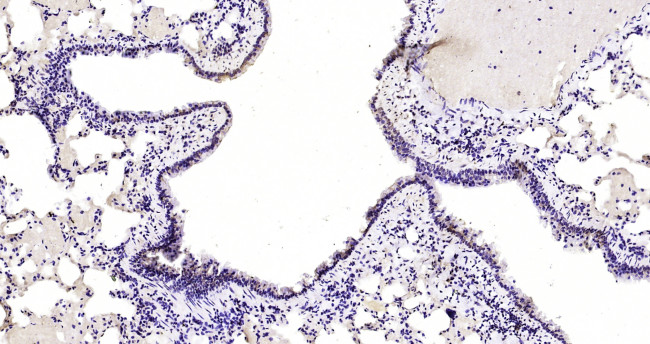 CUEDC2 Antibody in Immunohistochemistry (Paraffin) (IHC (P))