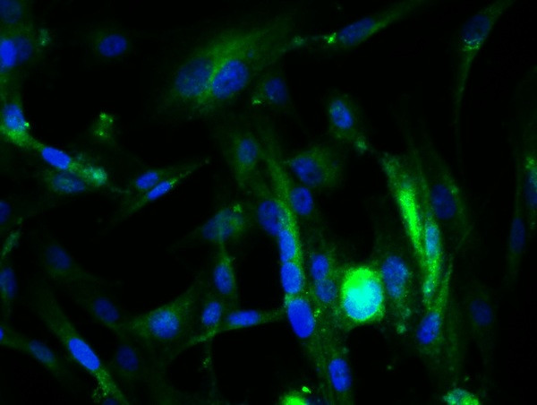 CD105 Antibody in Immunocytochemistry (ICC/IF)