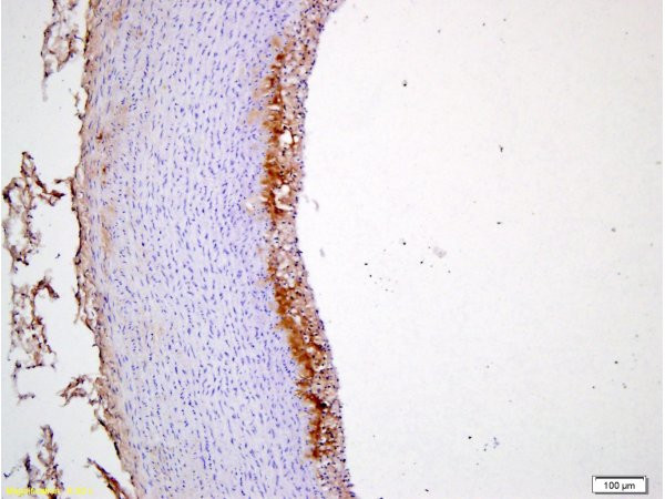 ICAM1 Antibody in Immunohistochemistry (Paraffin) (IHC (P))