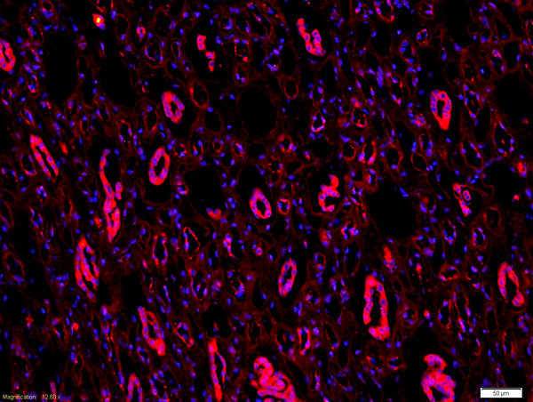 ICAM1 Antibody in Immunohistochemistry (Paraffin) (IHC (P))