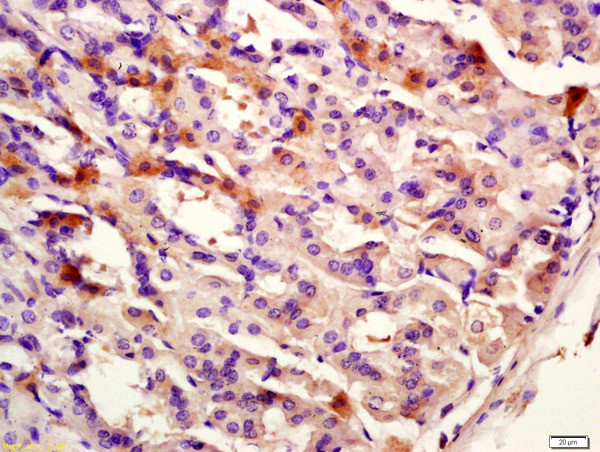 CK12 Antibody in Immunohistochemistry (Paraffin) (IHC (P))