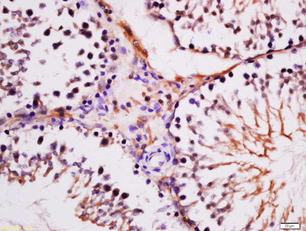 Epididymal secretory protein E4 Antibody in Immunohistochemistry (Paraffin) (IHC (P))