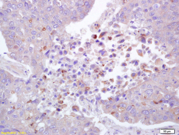 Phospho-ROCK1 (Thr455, Ser456) Antibody in Immunohistochemistry (Paraffin) (IHC (P))