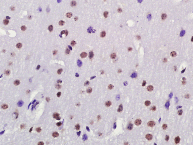Alpha B Crystallin Antibody in Immunohistochemistry (Paraffin) (IHC (P))